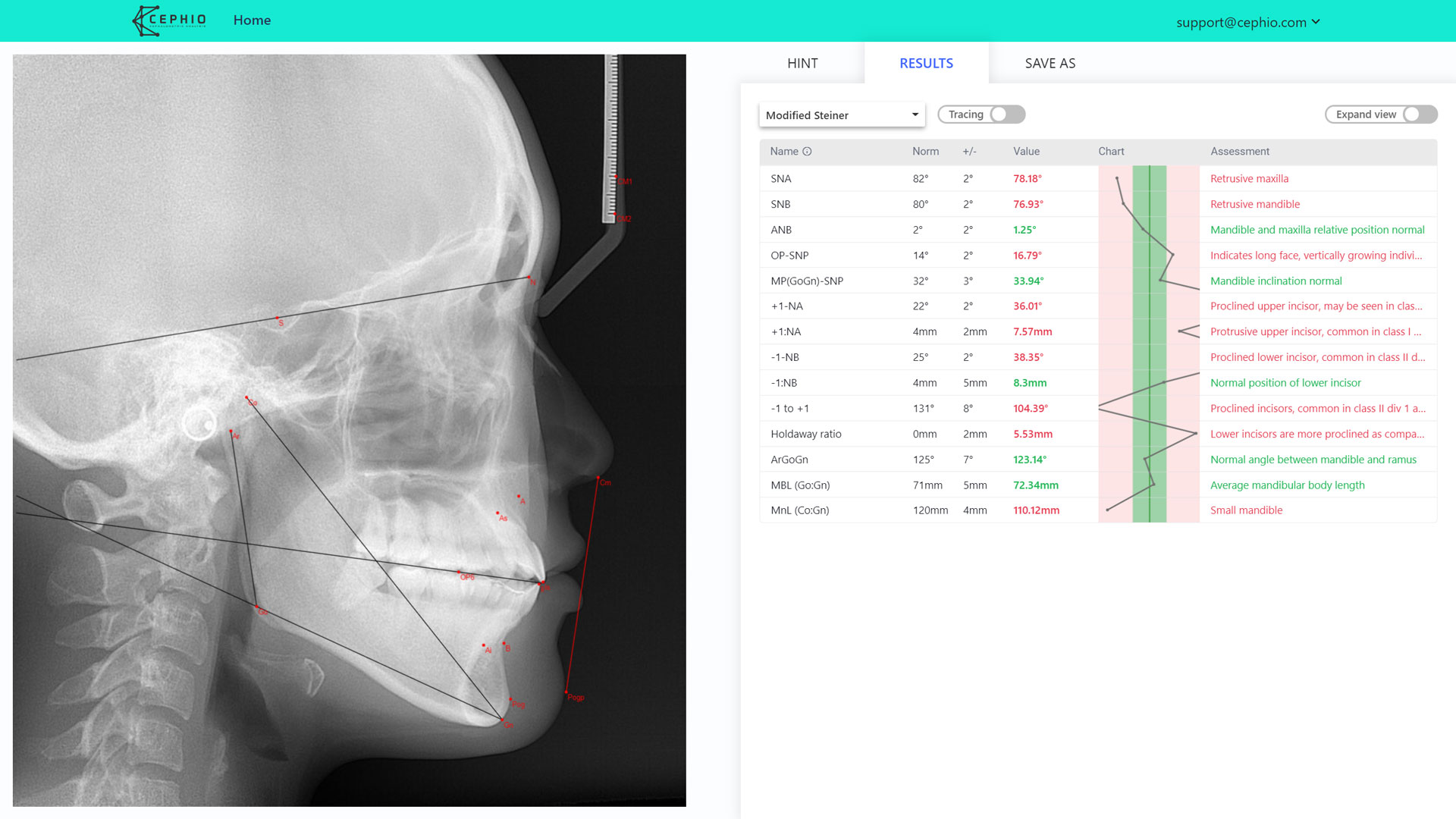 Steiner cephalometric analysis.